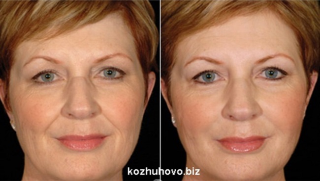 Multipeptide complex.jpg