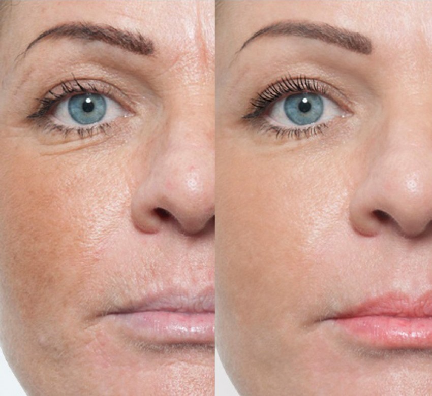 Alinex, геропротекторный комплекс.jpg