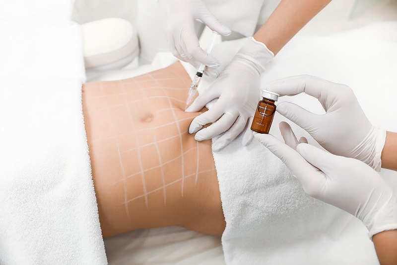 МЕЗОТЕРАПИЯ ТЕЛА.jpg